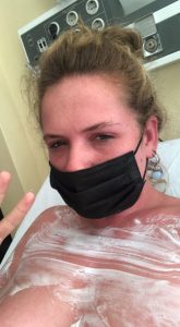 Read more about the article Woman Suffers 90 Percent Burns After Visiting Solarium Offering Two For Price Of One Deal