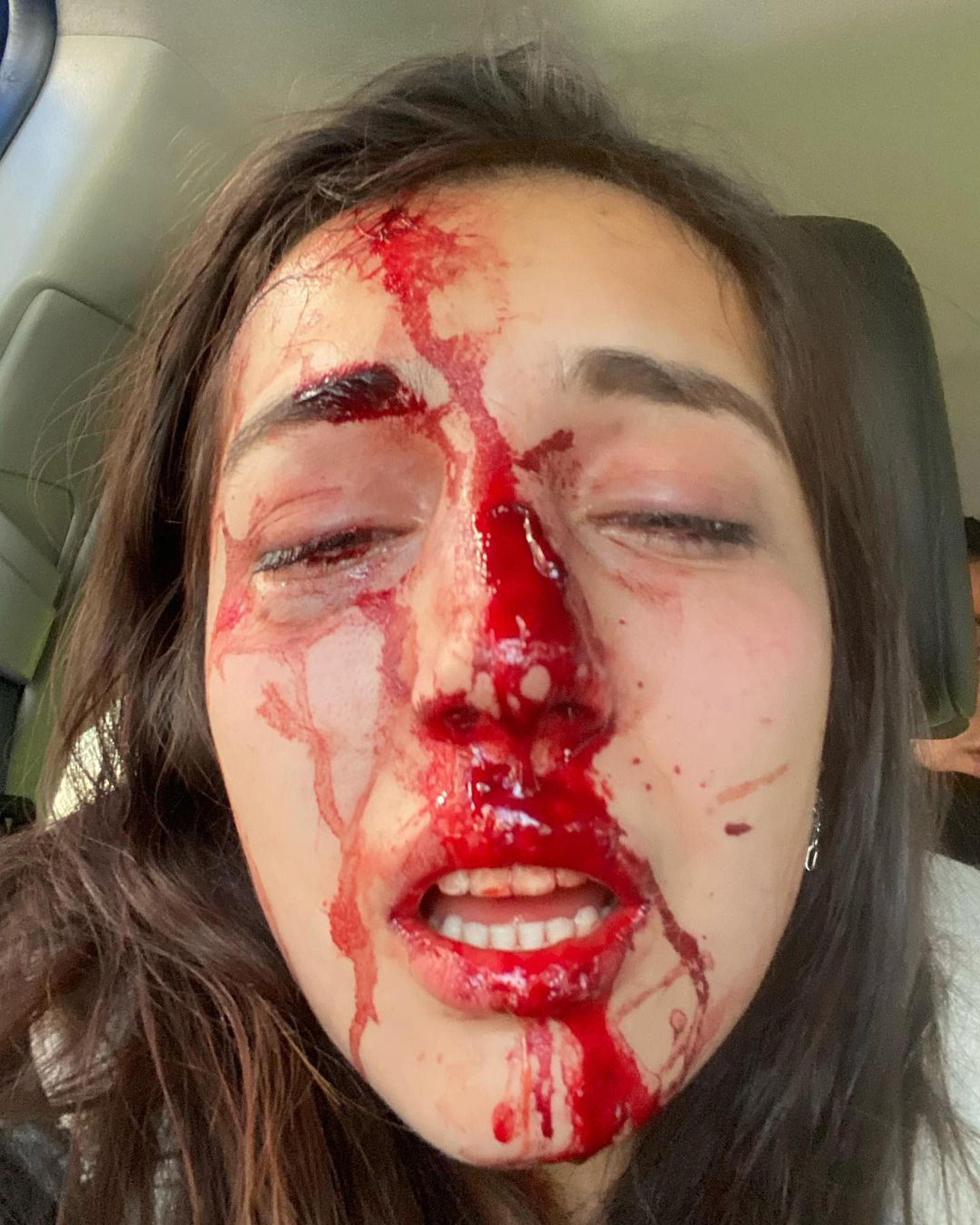 Read more about the article Model Shares Shock Images Of Facial Injuries In Viral Posts That Launch Investigation Against Boyfriend