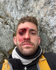 Read more about the article Injured Tourist Records Desperate Vid Asking Rescuers To Contact Mum After Becoming Stuck In Glacier Crack