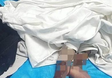 Girl, 4, Narrowly Avoids Having Both Legs Amputated After Stepmum Burns Her With Boiling Water