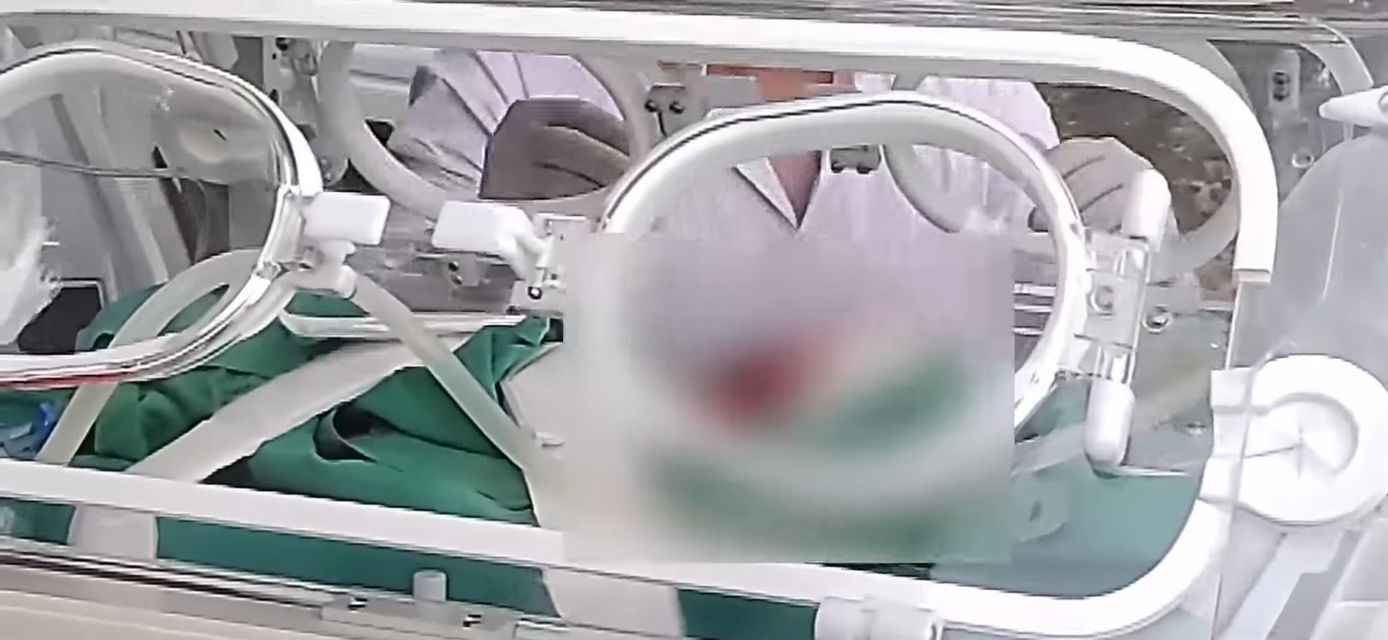 Read more about the article Premature Baby Nearly Buried Alive After Being Declared Stillborn By Doctor Before Funeral Director Finds Heartbeat