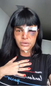Read more about the article Man Gets Nine Years For Horrific Attack On Trans Model, Leaving Her With Broken Nose And Jaw