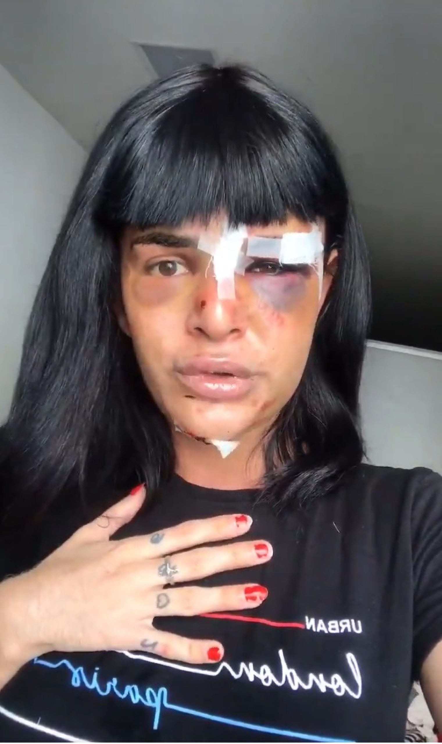 Read more about the article Man Gets Nine Years For Horrific Attack On Trans Model, Leaving Her With Broken Nose And Jaw