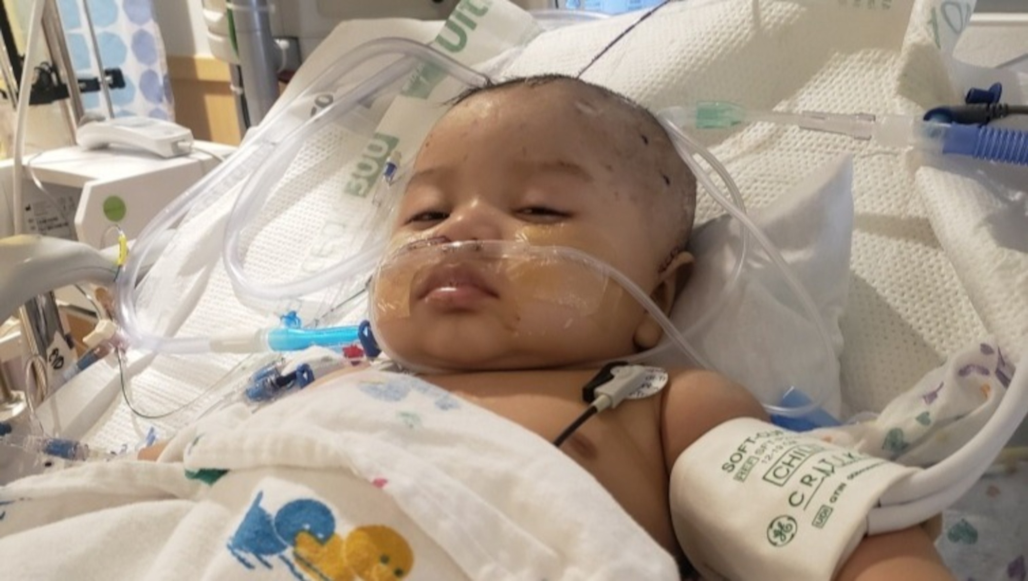 Read more about the article Texas Baby In ICU After Babysitter Throws Him Across Room