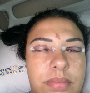 Read more about the article Bungling Beautician Superglues Customers Eyelashes Shut Nearly Blinding Her