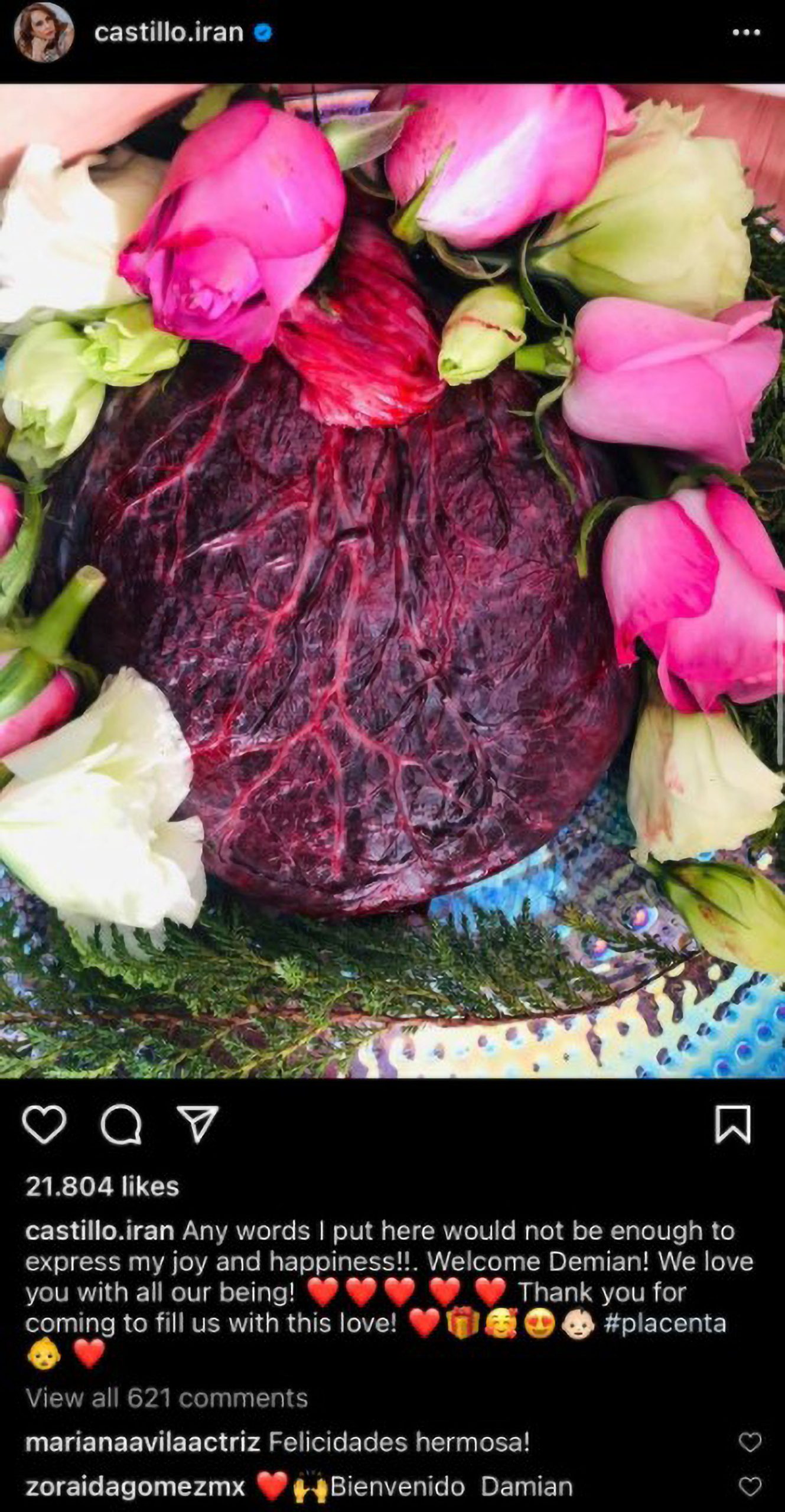 Read more about the article Mexican Actress Shares Snap Of Flower Covered Placenta As She Hails The Benefits Of Eating It