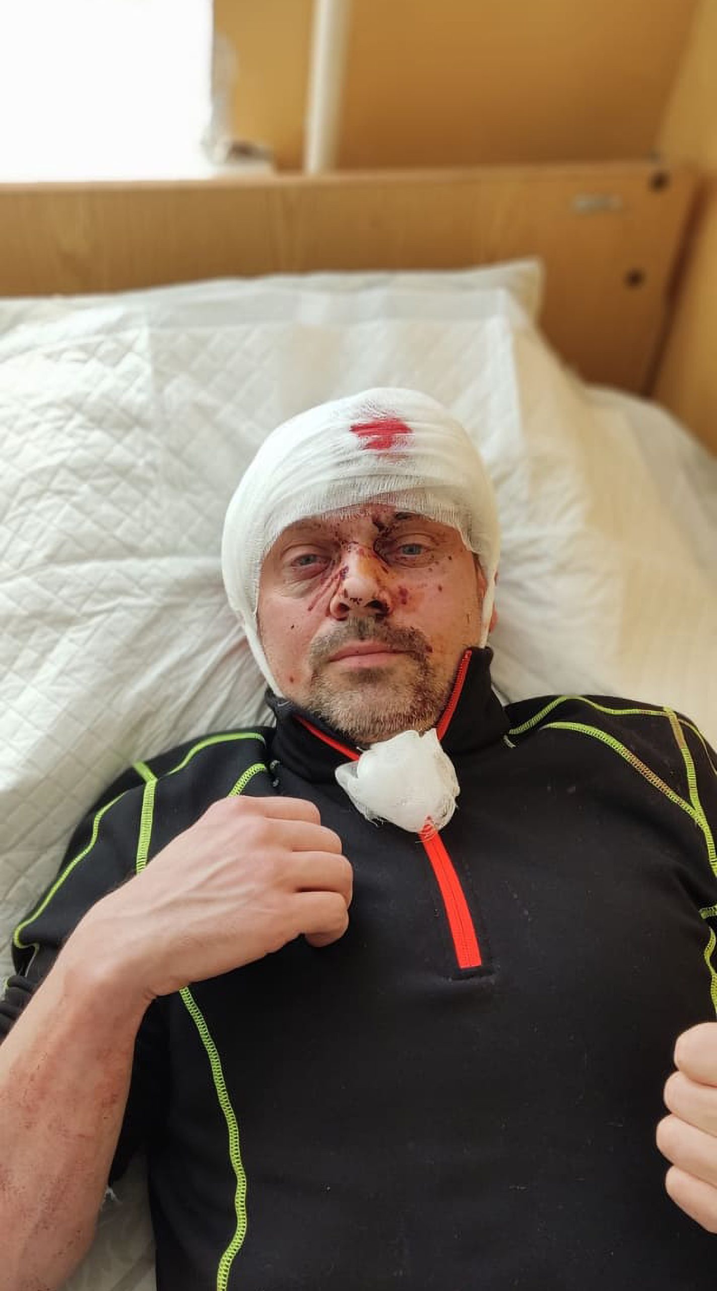 Read more about the article TOUGH NUT: Hero Firefighter Who Rescued Wife From Ukraine Shrugs Off Shrapnel In Head