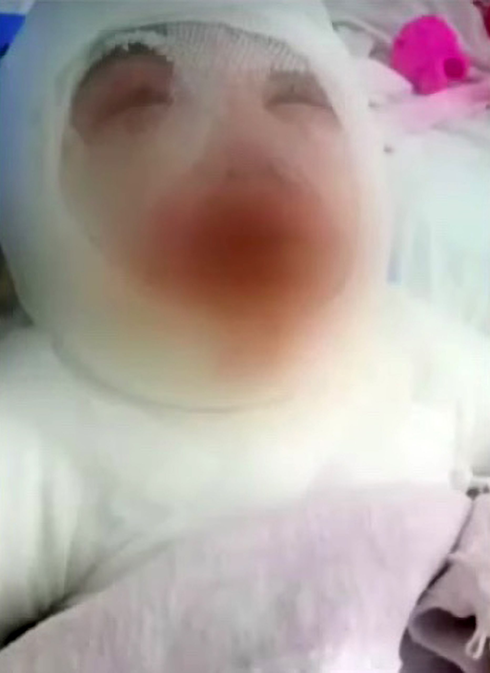 Read more about the article CROWD FUND: Girl, 3, Suffers Serious Burns After Restaurant Worker Spills Boiling Oil Over Her