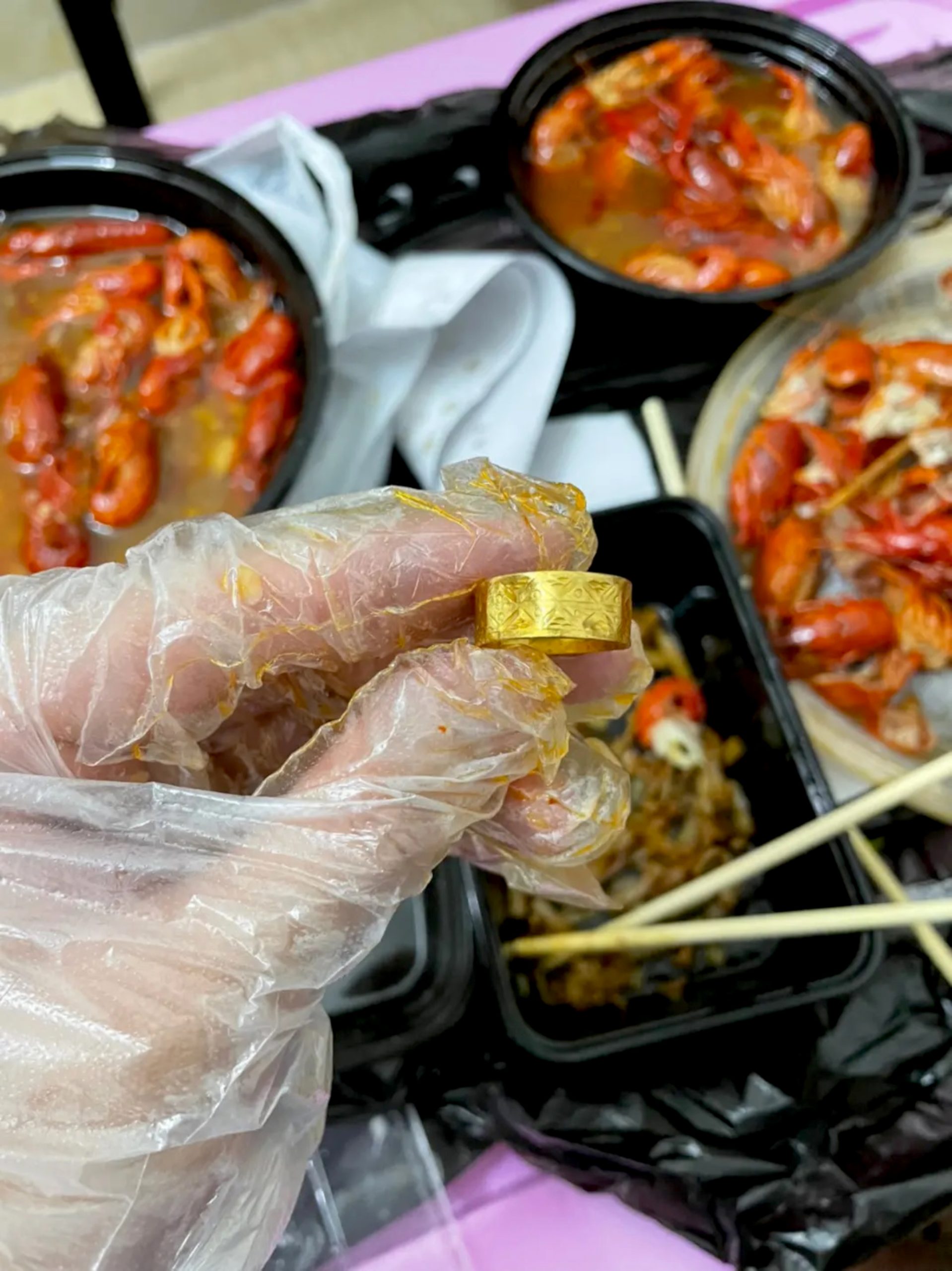 Read more about the article GOLD FILLING: Man Swallows Valuable Ring After It Dropped Off Chef’s Finger At Chinese Takeaway