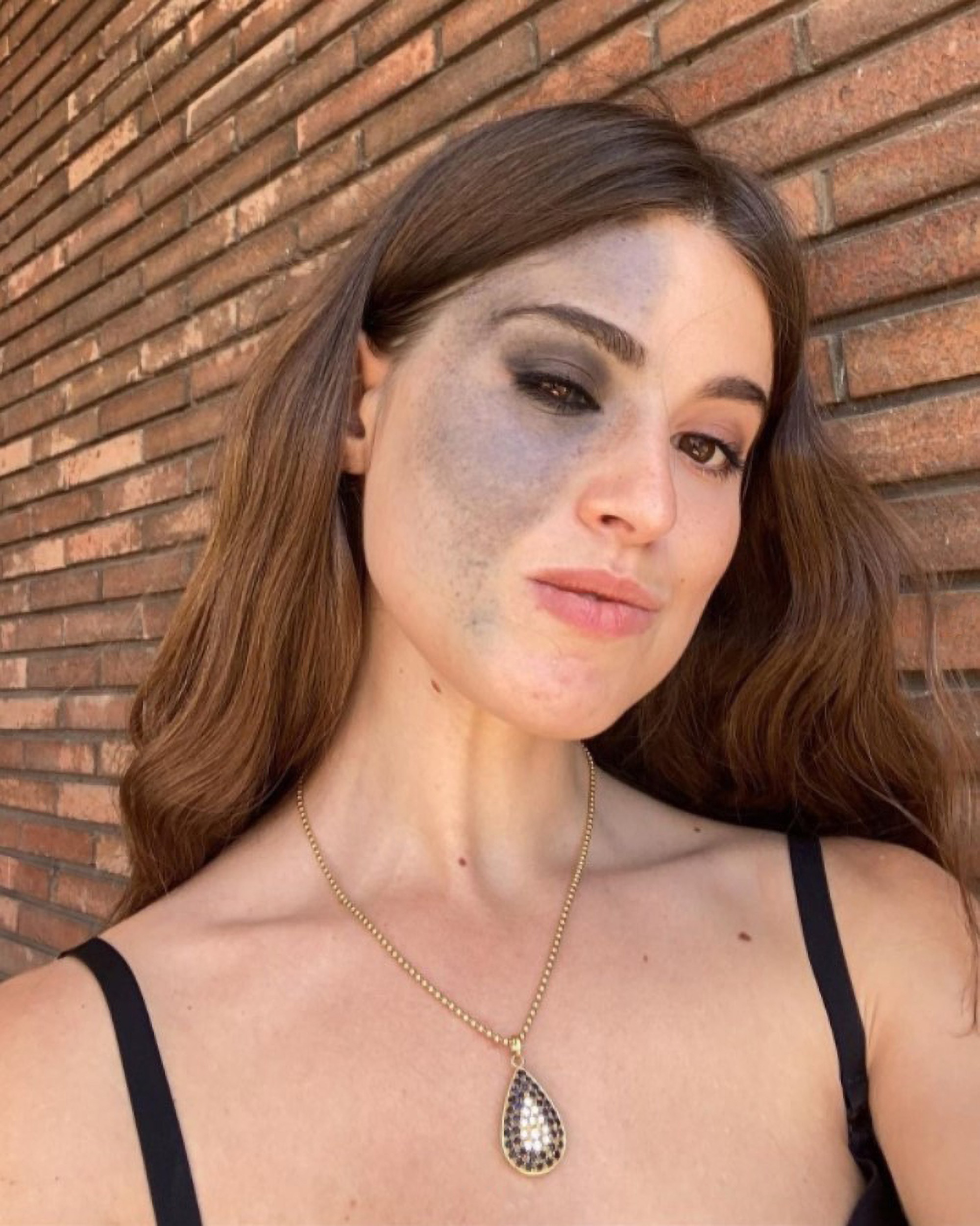 Read more about the article EYE’VE GOT YOUR BACK: Model With Eye Birthmark Tells Fans To Never Feel Alone