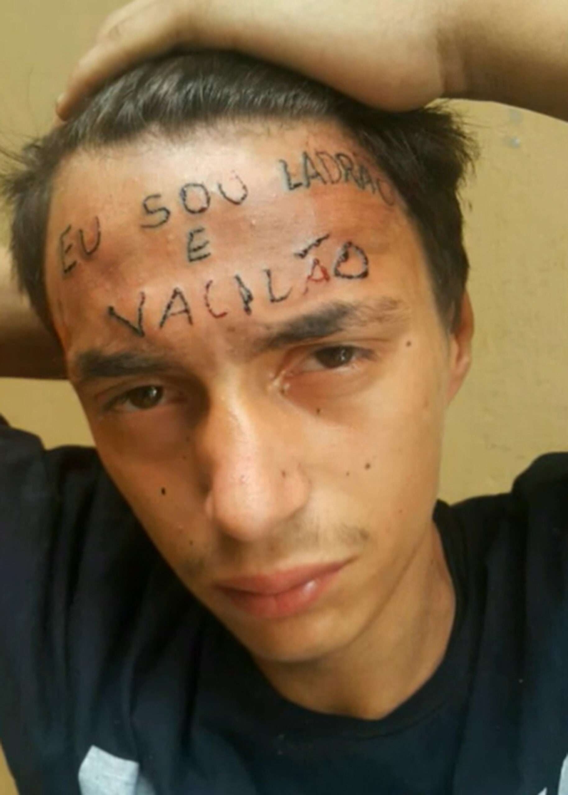 Read more about the article TAT’S QUITE A CLUE: Man With ‘I’m A Thief And Idiot’ Inked On Forehead Seized For Theft