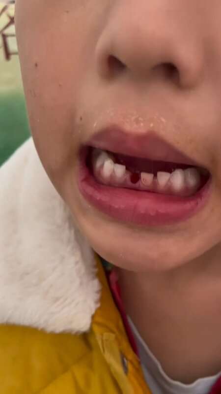 Read more about the article KUNG CHEW: Boy Pulls Out Own Tooth With Martial Arts Kick
