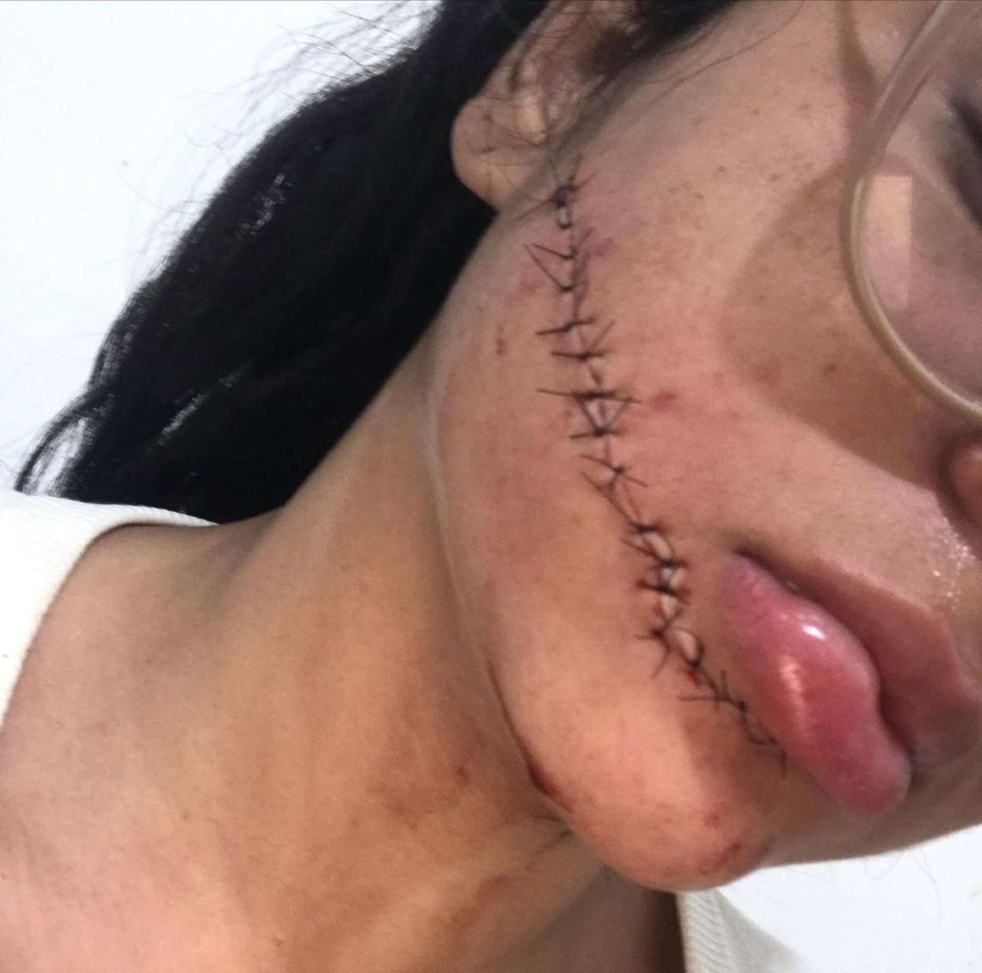 Read more about the article FACE OFF: Woman Suspected Of Slashing Face Of Student Nurse As She Slept On Bus Trip