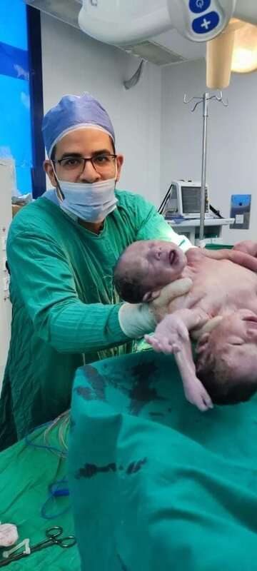 Read more about the article MEDICAL MARVELS: Mum Gives Birth To Conjoined Twins