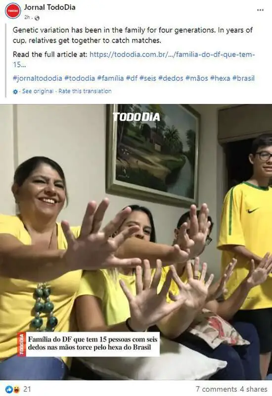 Read more about the article SILVA LINING: Family That Boasts Six Digits On Each Hand Hopes For Brazil’s Sixth World Cup Win