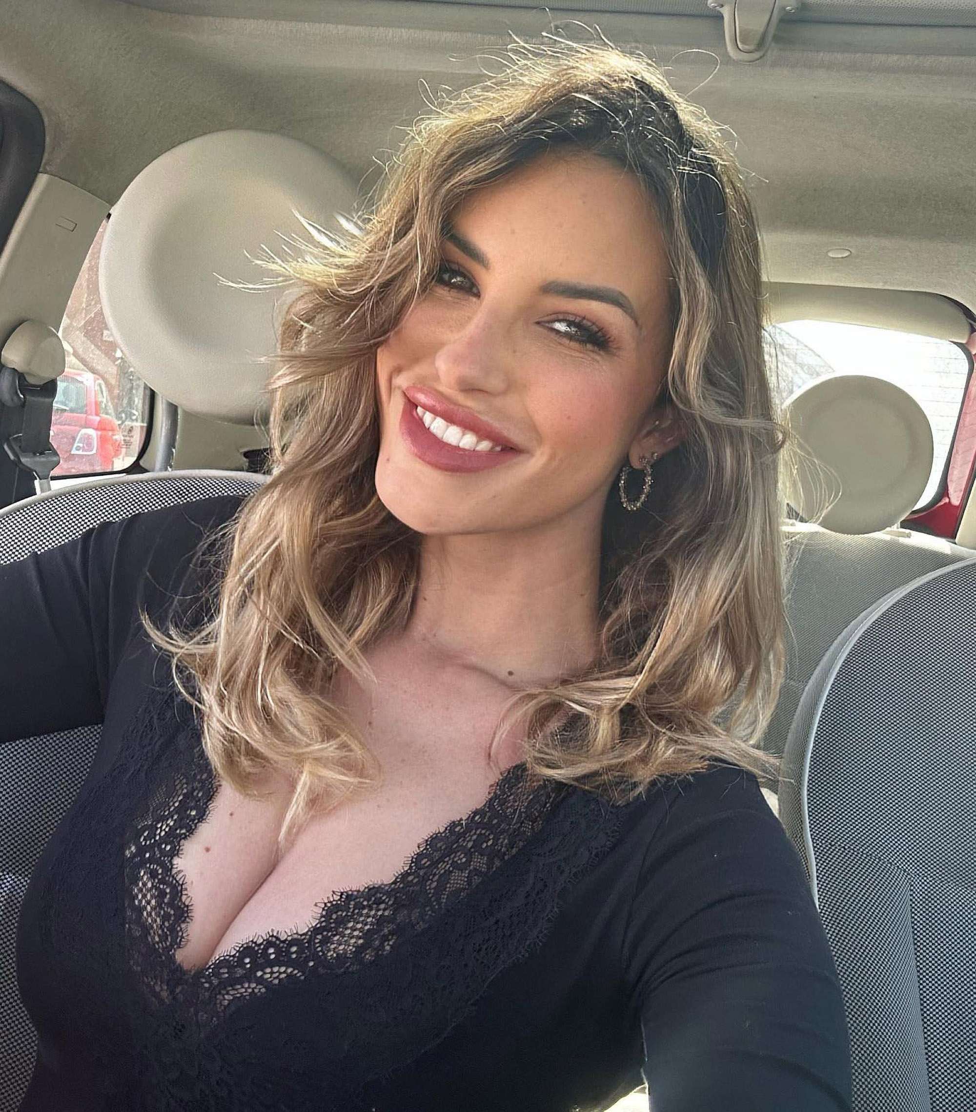 Read more about the article Influencer Who Feared Death After Car Crash Shares Pics Of Injuries