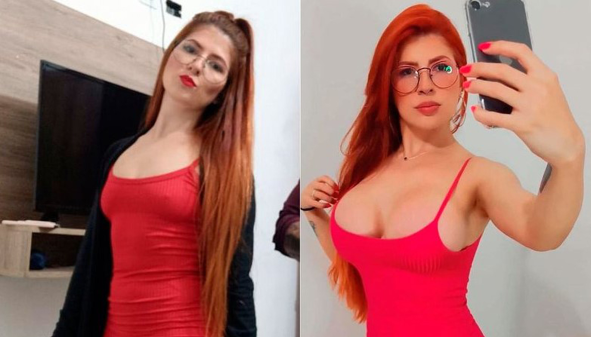 Read more about the article Model Stunned After D-Cup Boob Job Turbo Boosted Her Social Media Profile To Influencer Status